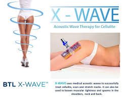 x-wave - cellulit és stria kezelés